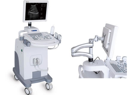 DW-370,全數(shù)字超聲診斷儀,推車式黑白B超機(jī)