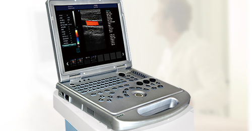 彩超機(jī),大為彩超,大為彩超機(jī),多普勒彩超,