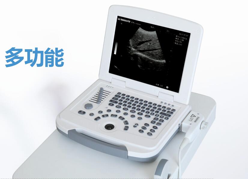 B超,B超機(jī),大為超聲品牌,B超機(jī)什么品牌好