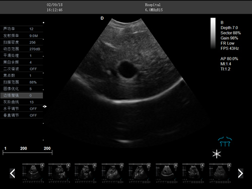 S7推車式獸用彩超機-寵物b超機掃描圖